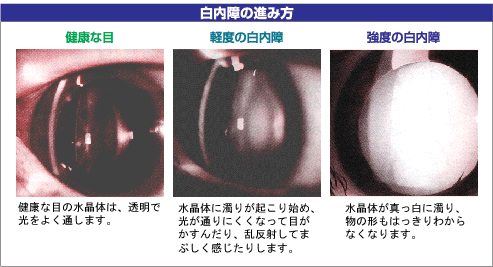 ophthalmology01